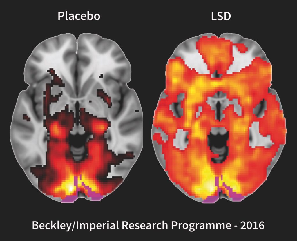 Hos testpersonerna som tog LSD började hela hjärnan bearbeta synintryck – de ”såg med slutna ögon”.
